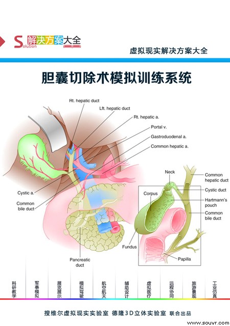 第一部分是解剖胆囊三角,切除并分割胆囊管及